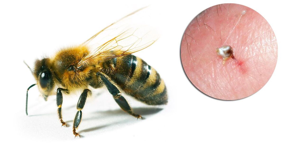 Hondrostrong chứa nọc ong, giúp cải thiện quá trình trao đổi chất trong các mô