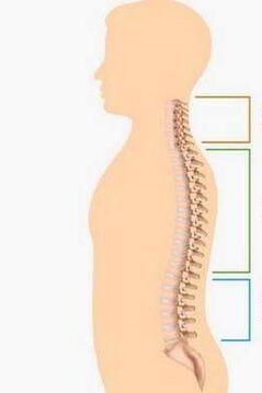 đánh bại bởi hoại tử xương của các phần khác nhau của cột sống